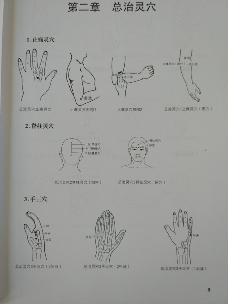 第一章:手穴治百痛 第二章总治灵穴 第三章金针渡穴 第四章太极针法